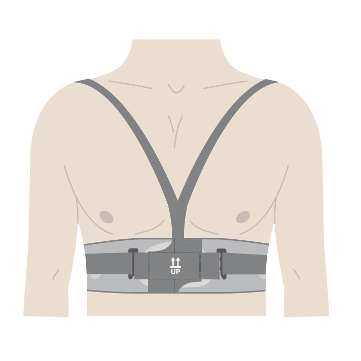 Holtery EKG – rejestratory NUUBO nECG