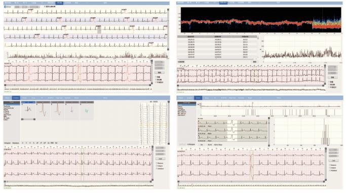 Holtery EKG – rejestratory Rencare Rencare e3 plus