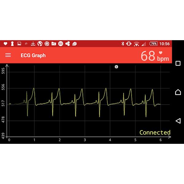 Holtery EKG – rejestratory Savvy SmartPhone EKG / WiFi EKG