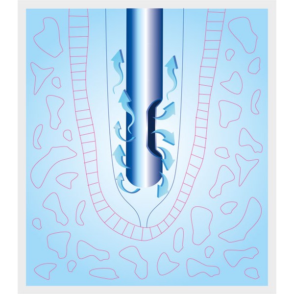 Igły irygacyjne (do przemywań) Cerkamed Endo-Top