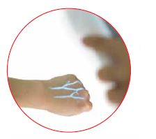 Iluminatory naczyniowe (skanery żył) Enmind VV-100