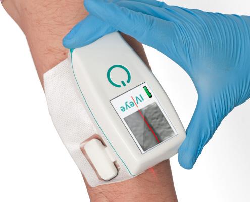 Iluminatory naczyniowe (skanery żył) Novarix IV-eye