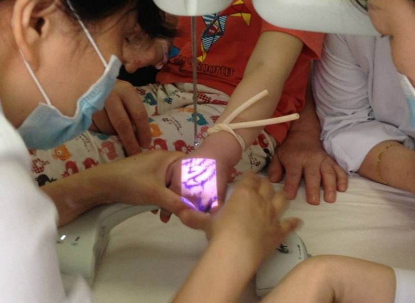 Iluminatory naczyniowe (skanery żył) ZD - Medical Inc. JM-260-01