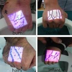 Iluminatory naczyniowe (skanery żył) ZD - Medical Inc. ZD-260-04