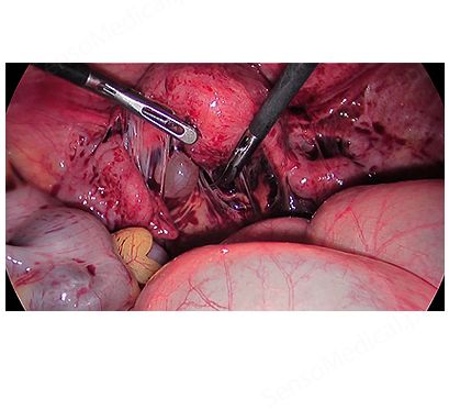 Kamery endoskopowe SOPRO-COMEG SOPRO 368 HD 3CCD