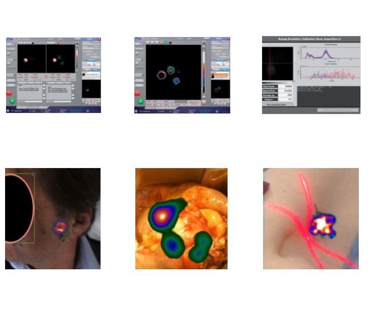 Kamery Gamma onkologiczne ONCOVISION Sentinella