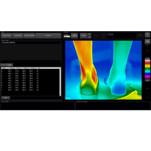 Kamery termograficzne do diagnostyki pacjentów THERMIDAS IRT-384