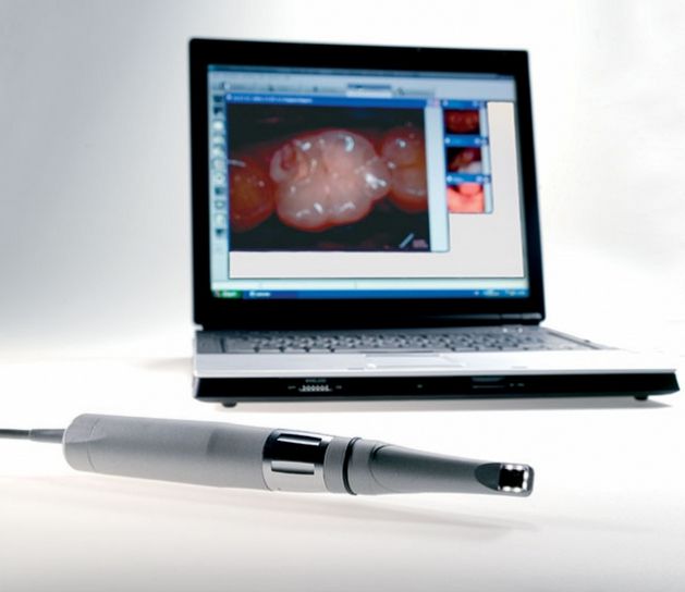 Kamery wewnątrzustne Durr Dental VistaCam