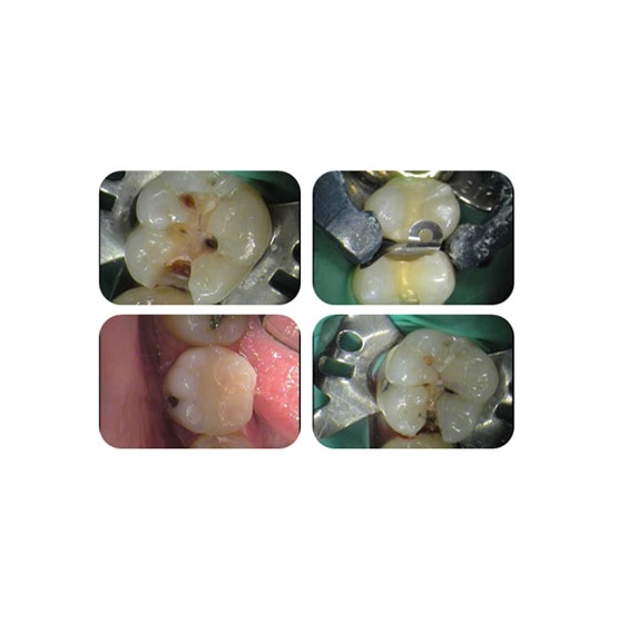 Kamery wewnątrzustne WINUS U CAM