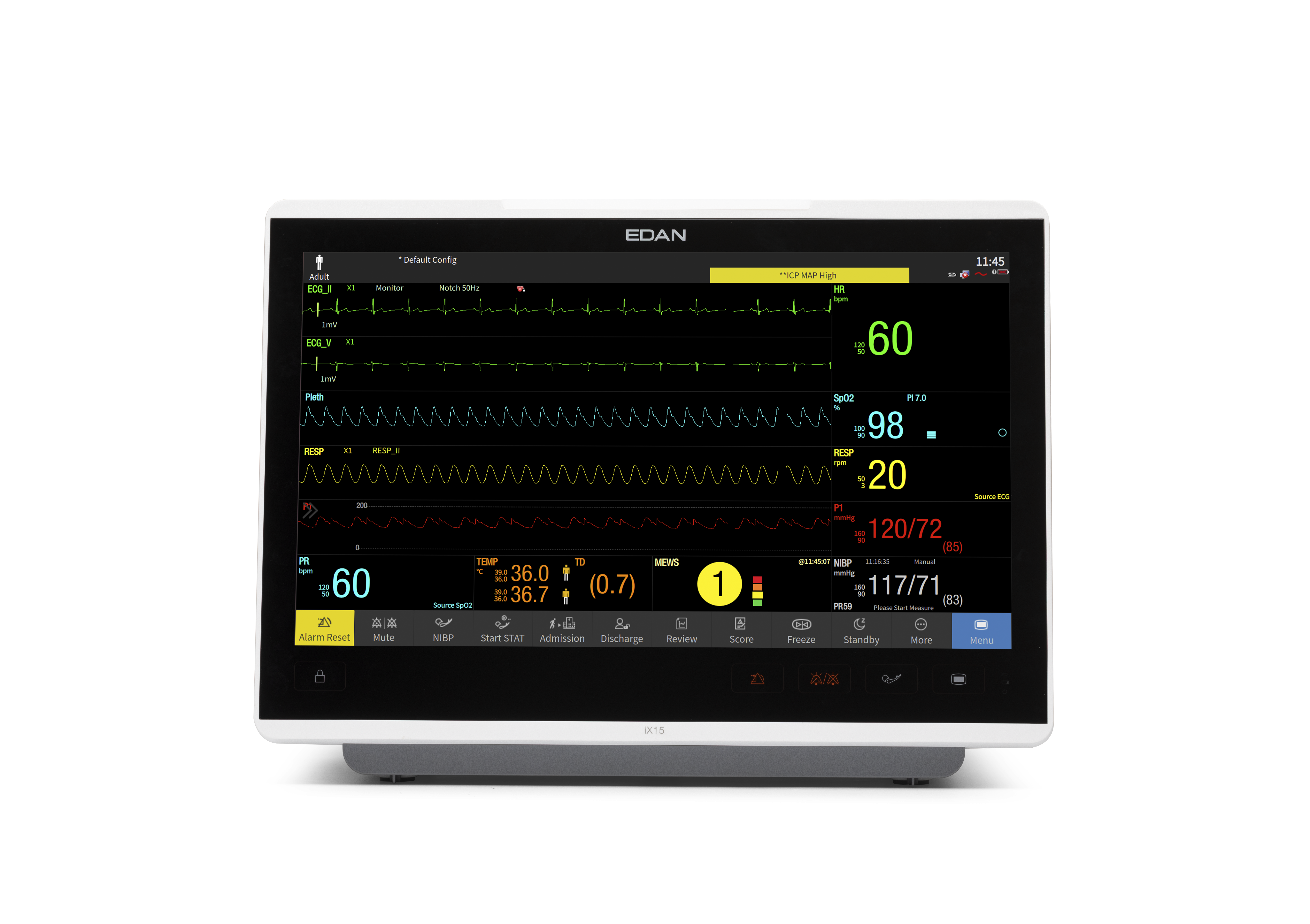 Kardiomonitory przyłóżkowe EDAN iX10 / iX12 / iX15