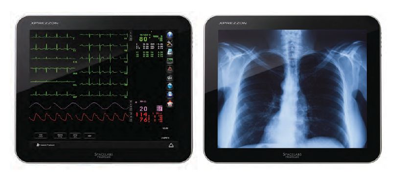 Kardiomonitory przyłóżkowe SPACELABS XPREZZON