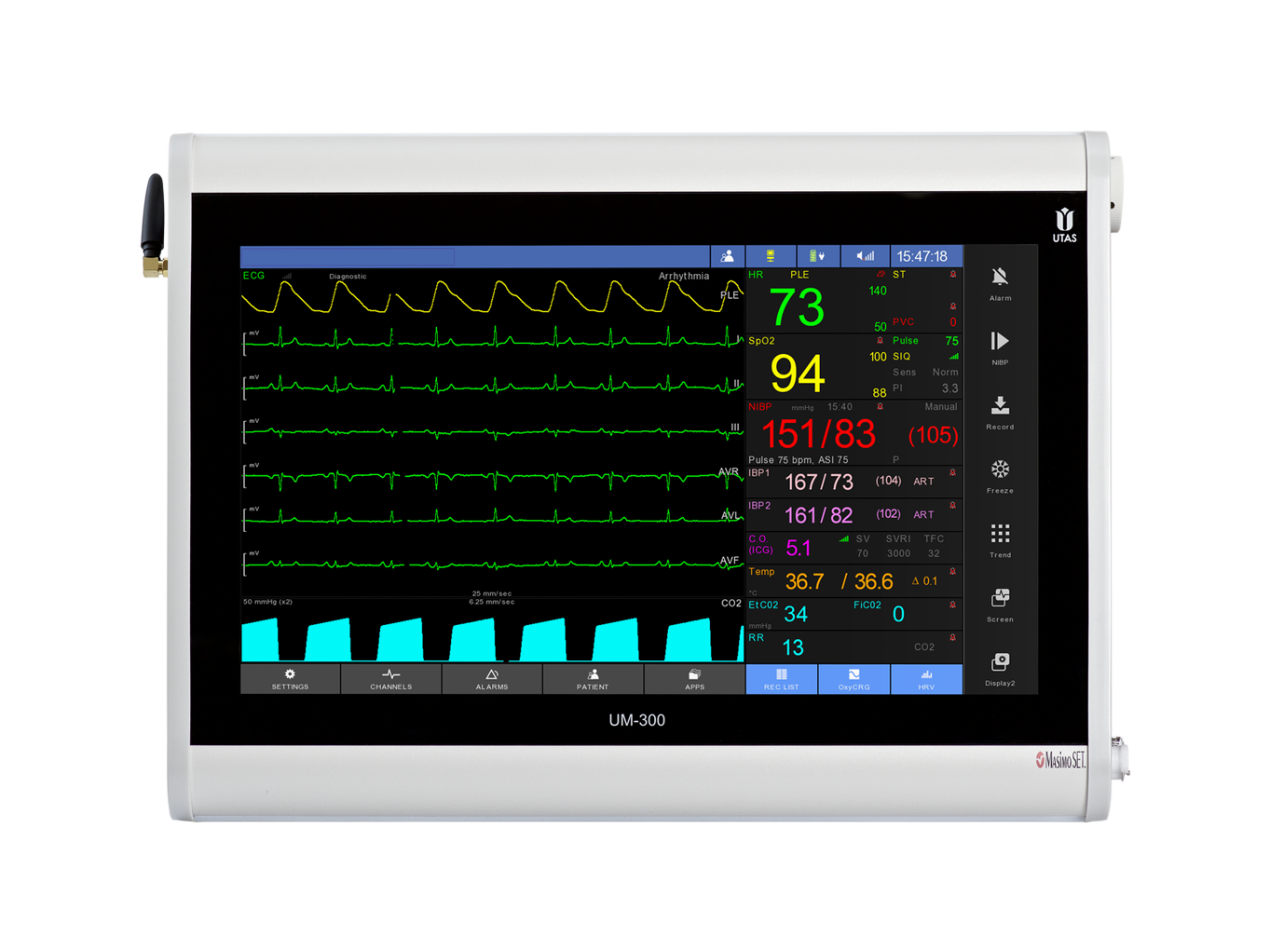 Kardiomonitory przyłóżkowe UTAS UM 300-S
