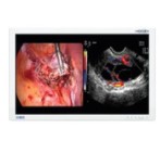 Laparoskopy - optyki laparoskopowe B/D zestaw