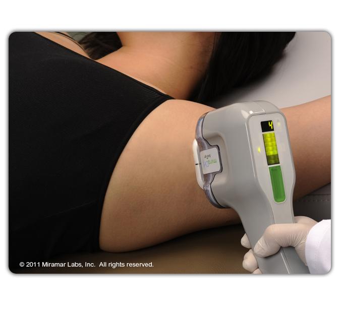 Lasery chirurgiczne miraDry System miraDry