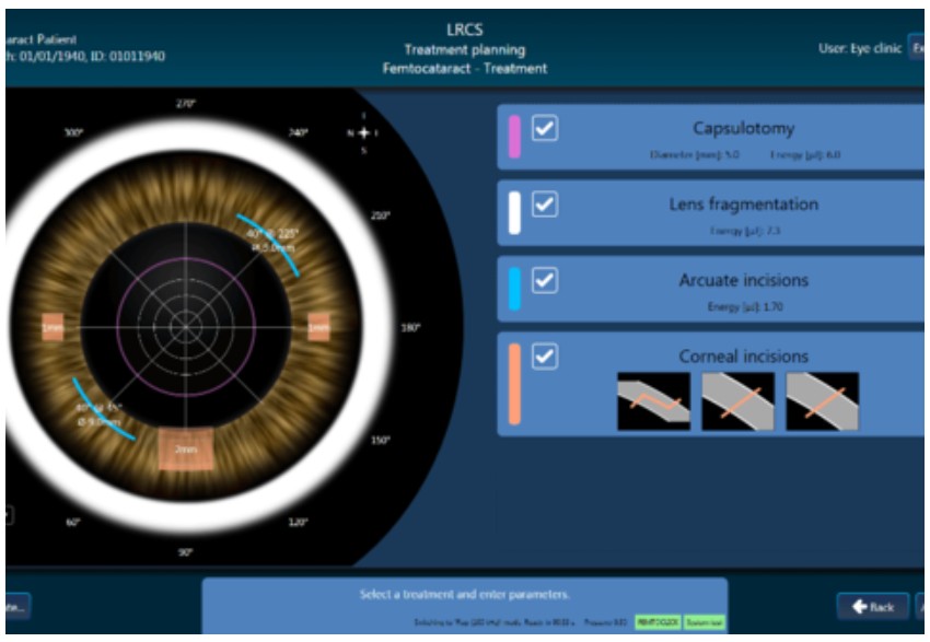 Lasery okulistyczne - Systemy Bausch & Lomb Victus