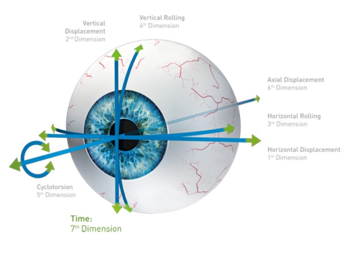 Lasery okulistyczne - Systemy SCHWIND AMARIS 1050RS