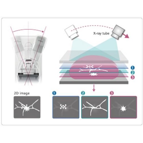 Mammografy FUJIFILM AMULET INNOVALITY