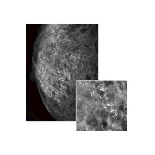 Mammografy FUJIFILM AMULET INNOVALITY