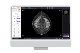 Mammografy GENORAY Hestia 2D