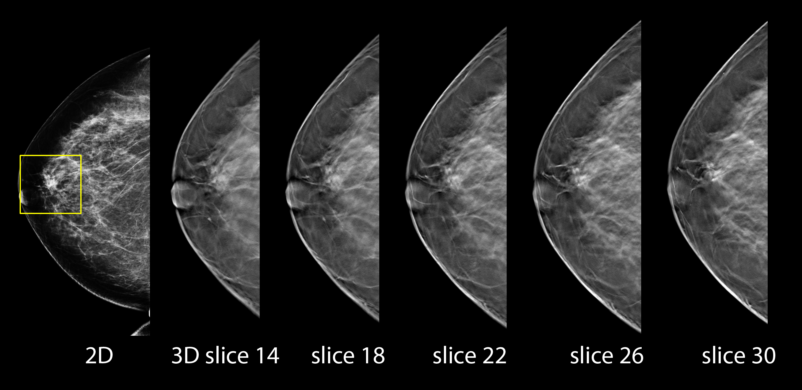 Mammografy HOLOGIC Selenia Dimensions 3D