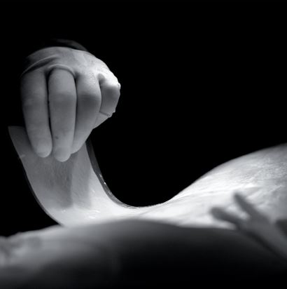 Matryce do regeneracji skóry właściwej Integra INTEGRA DRT (INTEGRA Skin)