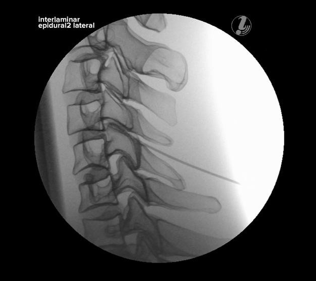 Modele zabiegowe 3B Scientific P67