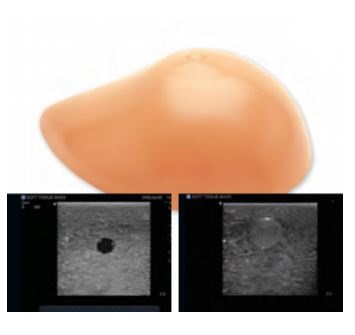 Modele zabiegowe CAE Healthcare Blue Phantom Breast Biopsy