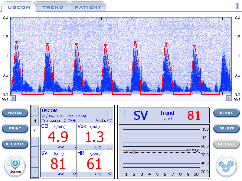 Monitory do pomiarów hemodynamicznych serca i krwi Uscom USCOM 1A