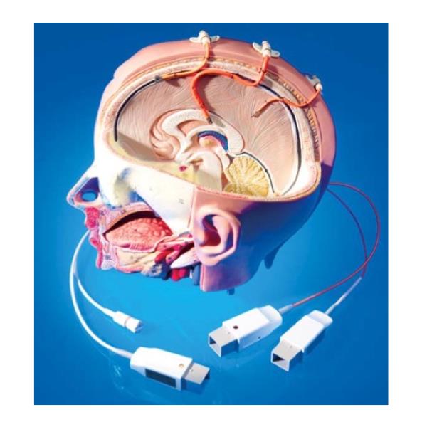 Monitory do pomiaru ciśnienia wewnątrzczaszkowego - Monitory ICP Raumedic AG DATALOGGER