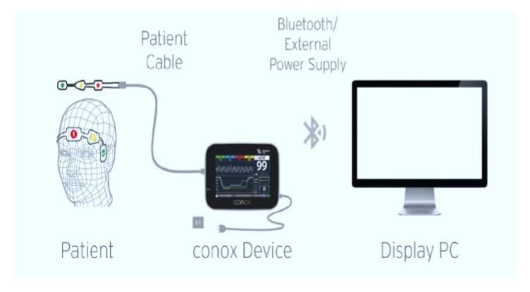 Monitory głębokości uśpienia Quantium Medical Conox