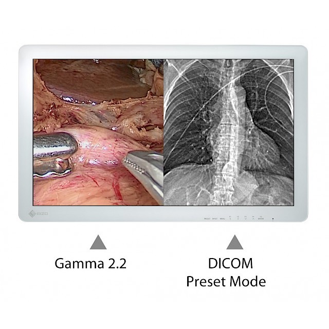 Monitory medyczne Eizo CuratOR EX3220