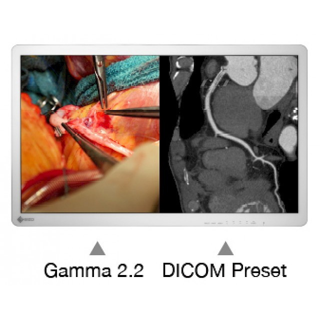 Monitory medyczne Eizo CuratOR EX3241