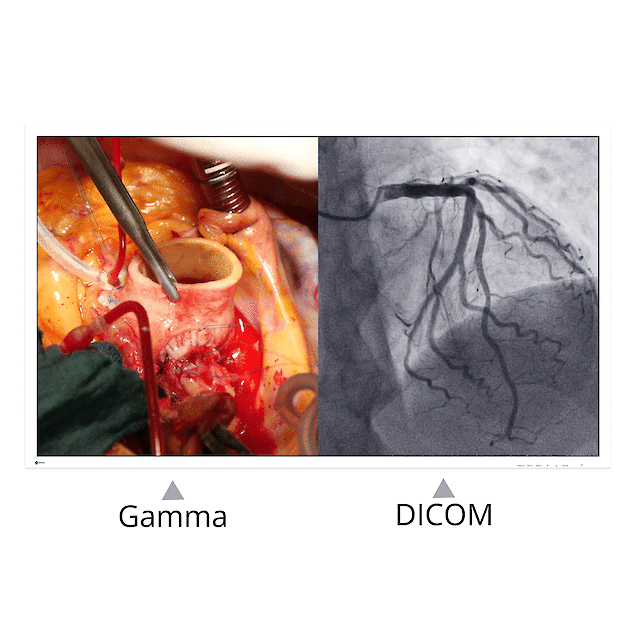 Monitory medyczne Eizo CuratOR EX3241