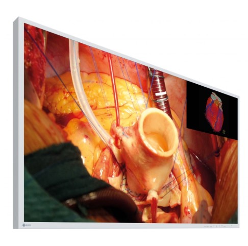 Monitory medyczne Eizo CuratOR EX4342