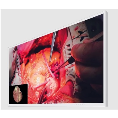 Monitory medyczne Eizo CuratOR EX4942