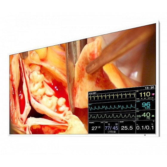 Monitory medyczne Eizo CuratOR LX491W