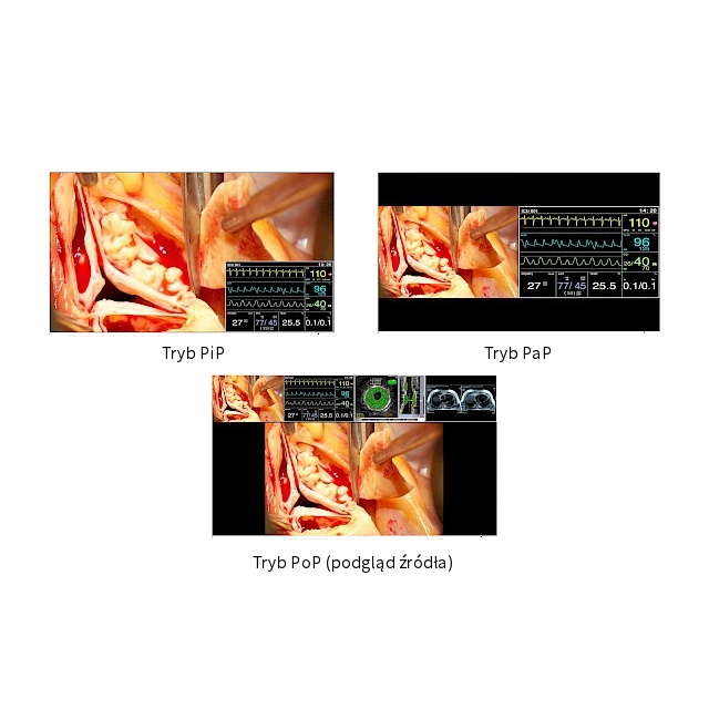 Monitory medyczne Eizo CuratOR LX491W