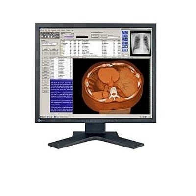 Monitory medyczne Eizo FlexScan MX190S