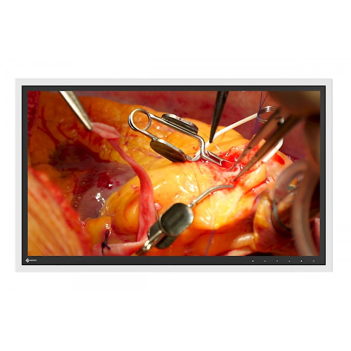 Monitory medyczne Eizo RadiForce EX271W