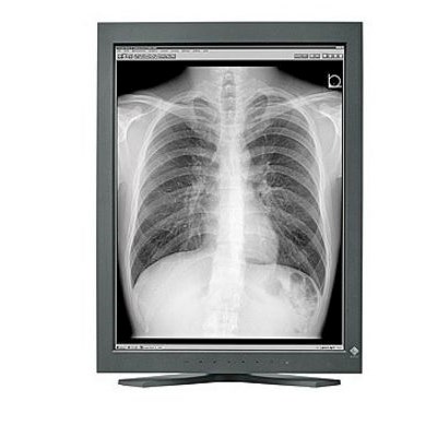 Monitory medyczne Eizo RadiForce GS320