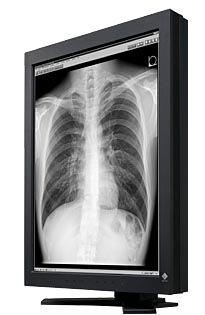 Monitory medyczne Eizo RadiForce GS320