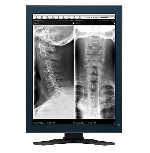 Monitory medyczne Eizo RadiForce GX220