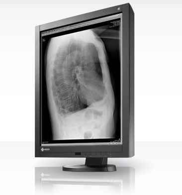Monitory medyczne Eizo RadiForce GX240