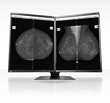 Monitory medyczne Eizo RadiForce GX560