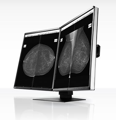 Monitory medyczne Eizo RadiForce GX560