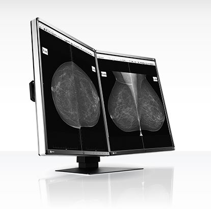 Monitory medyczne Eizo RadiForce GX560