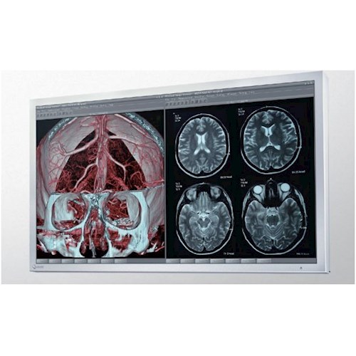 Monitory medyczne Eizo RadiForce LX470W