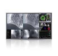 Monitory medyczne Eizo RadiForce LX600W