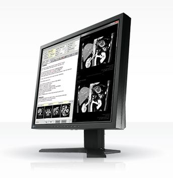 Monitory medyczne Eizo RadiForce MX194
