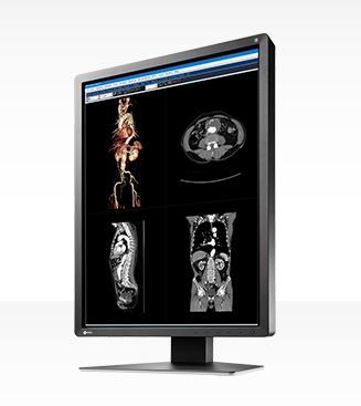Monitory medyczne Eizo RadiForce MX216